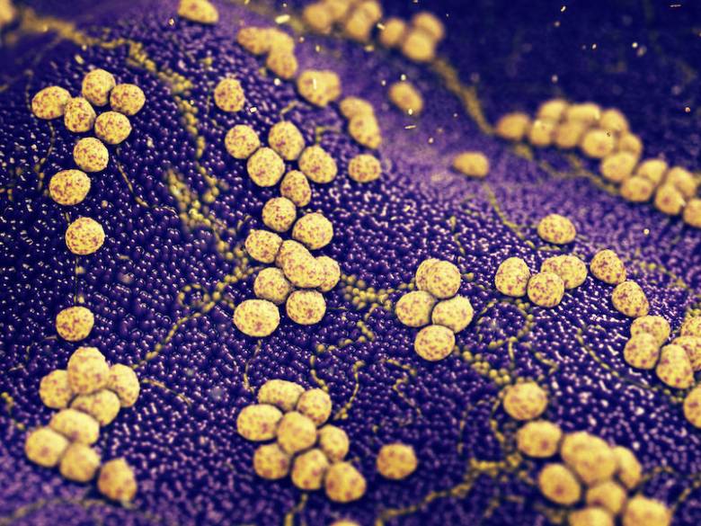 "Poisoned Arrow" Mengalahkan Bakteri Resisten Antibiotik